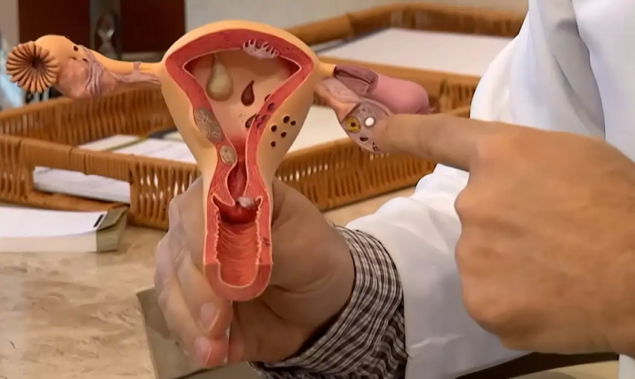 Diagnóstico clínico ainda é chave contra a endometriose