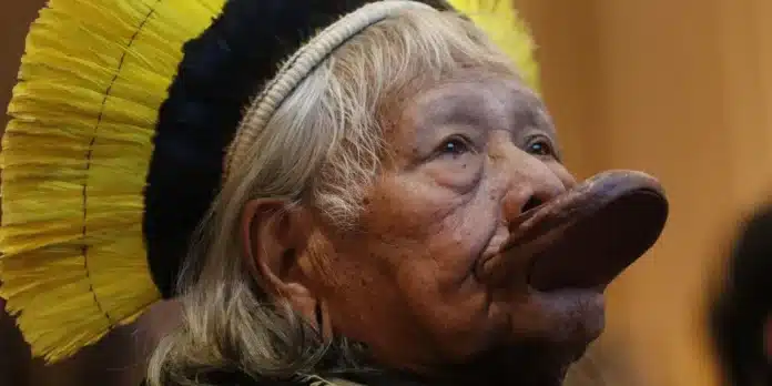 Cacique Raoni, 94, passará por cirurgia de desobstrução intestinal em São Paulo, procedimento marcado para sábado e equipe médica mantém quadro sob controle