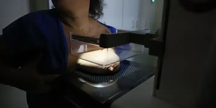 ANS propõe cobertura obrigatória de mamografia digital sem restrição de idade ou gênero em planos de saúde, entenda como ficará o acesso e o rastreamento